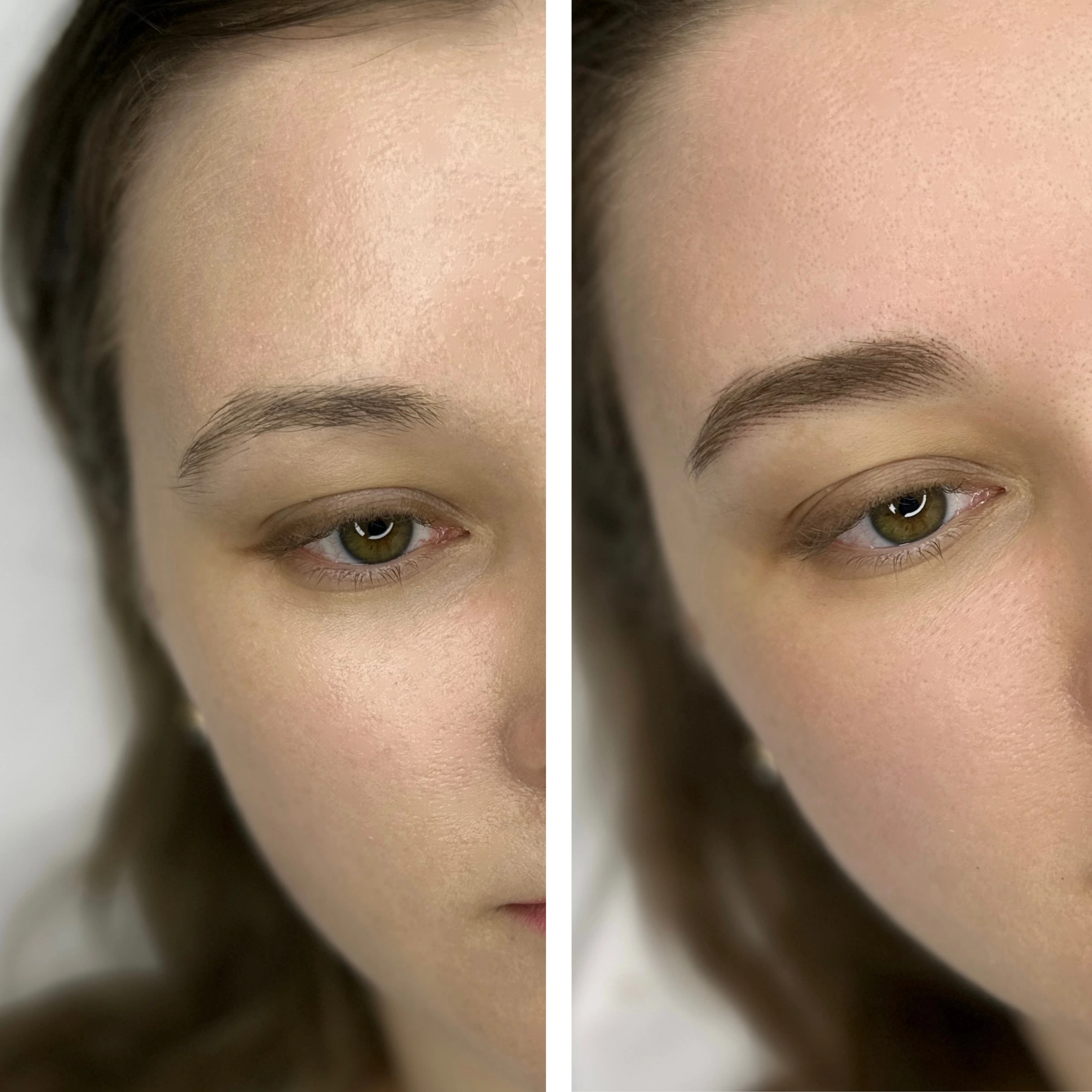Before-After 8
