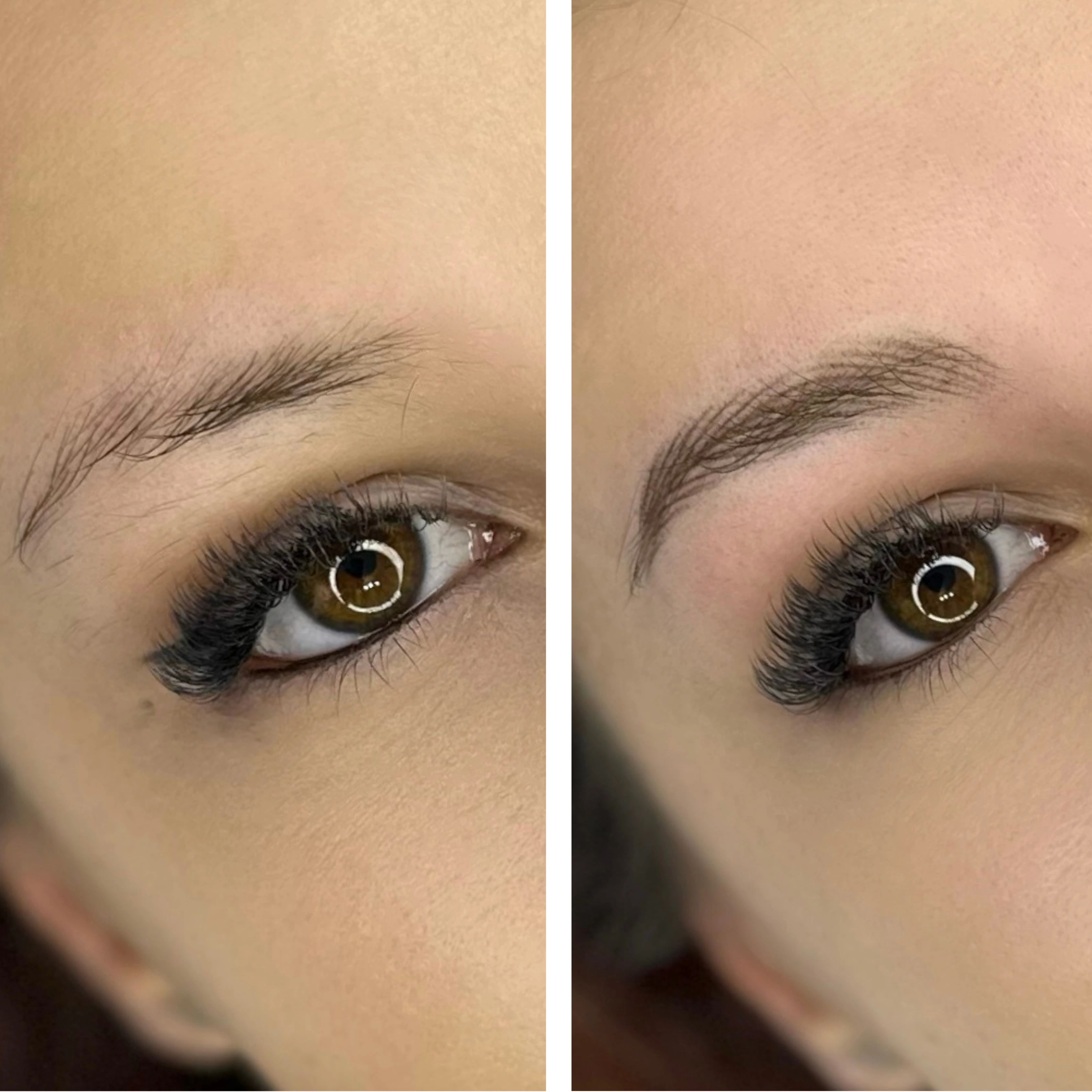 Before-After 1