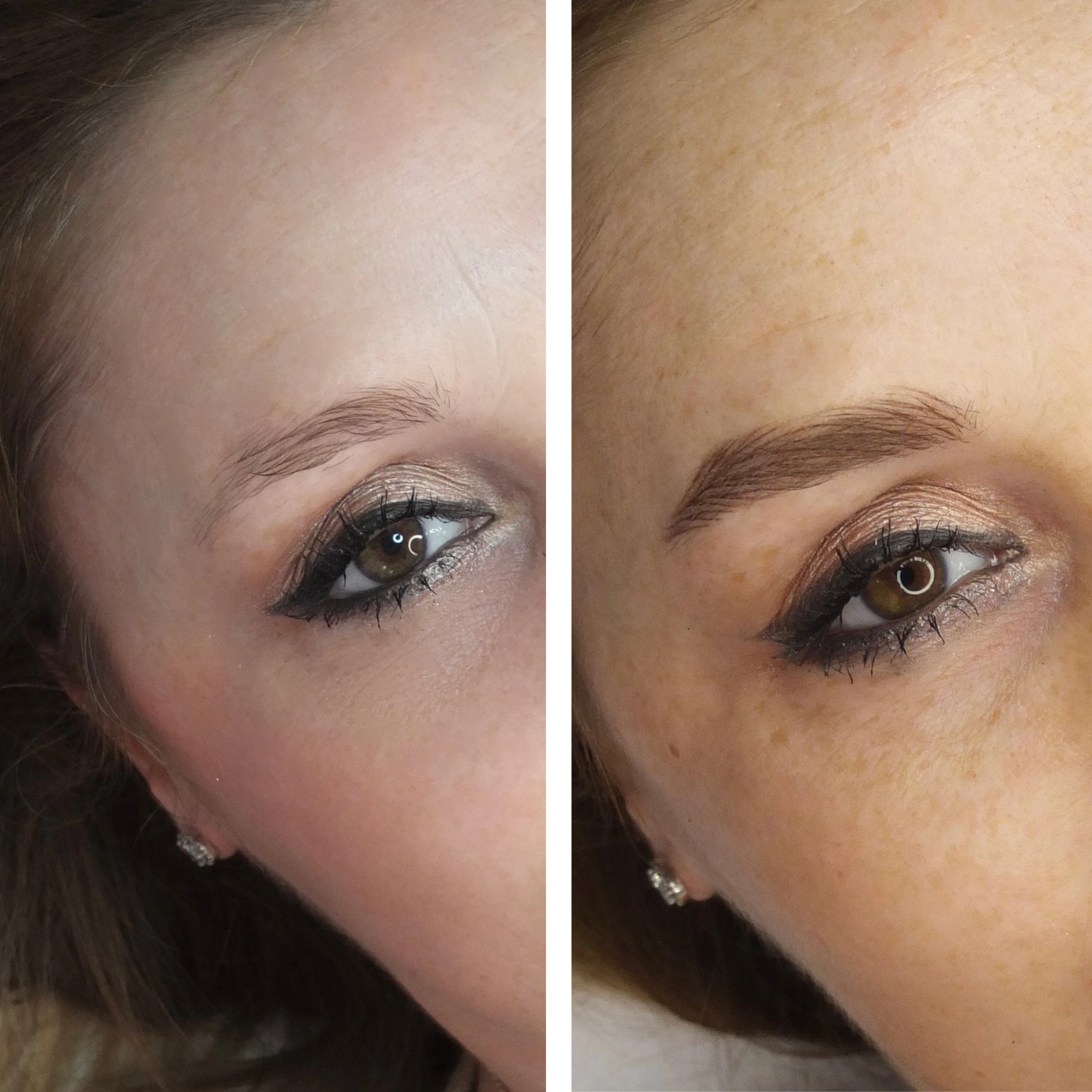 Before-After 2
