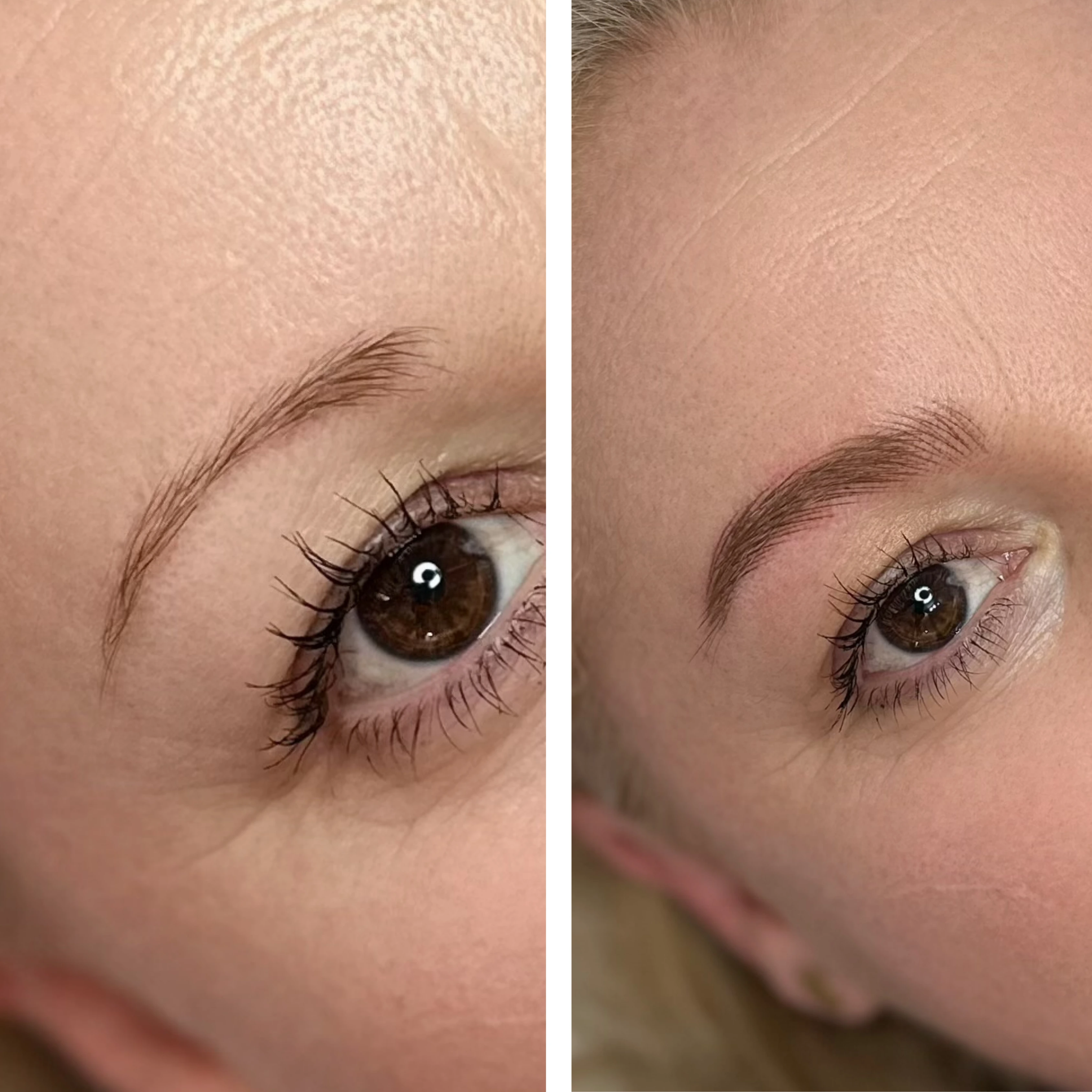 Before-After 3