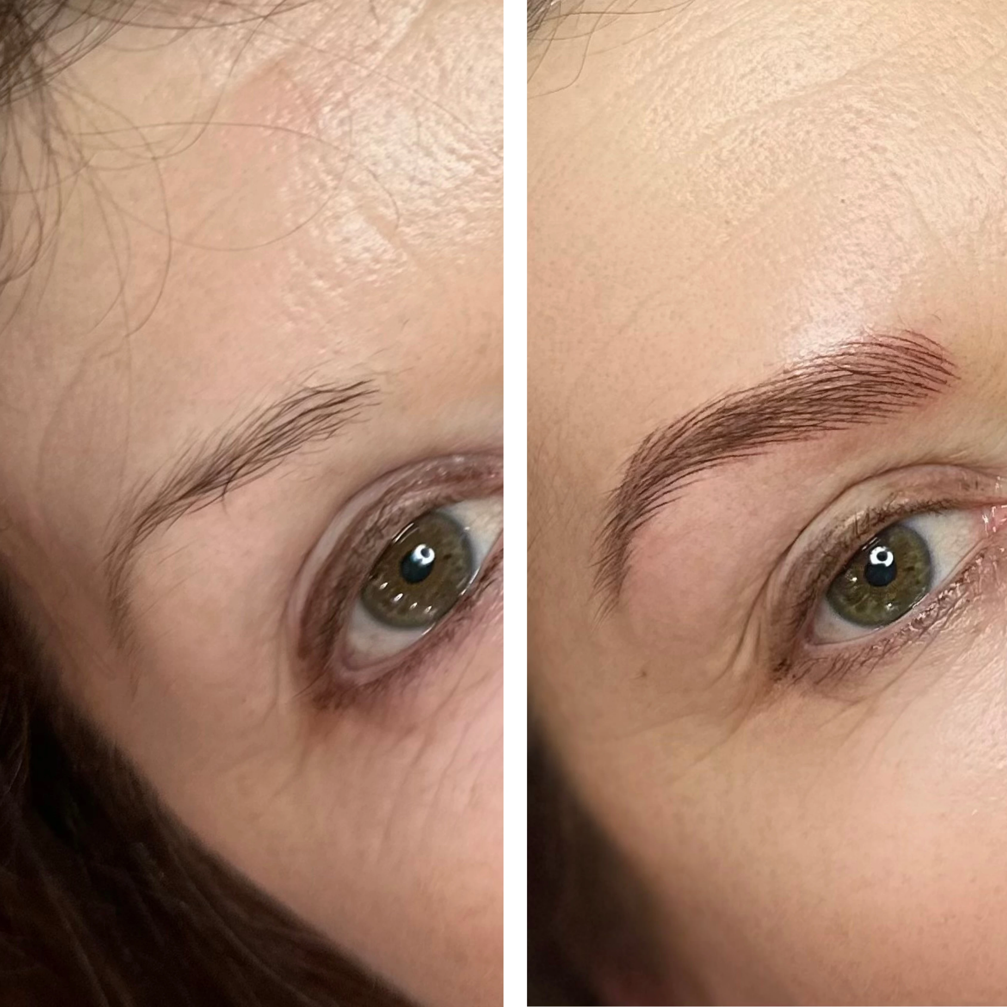 Before-After 4