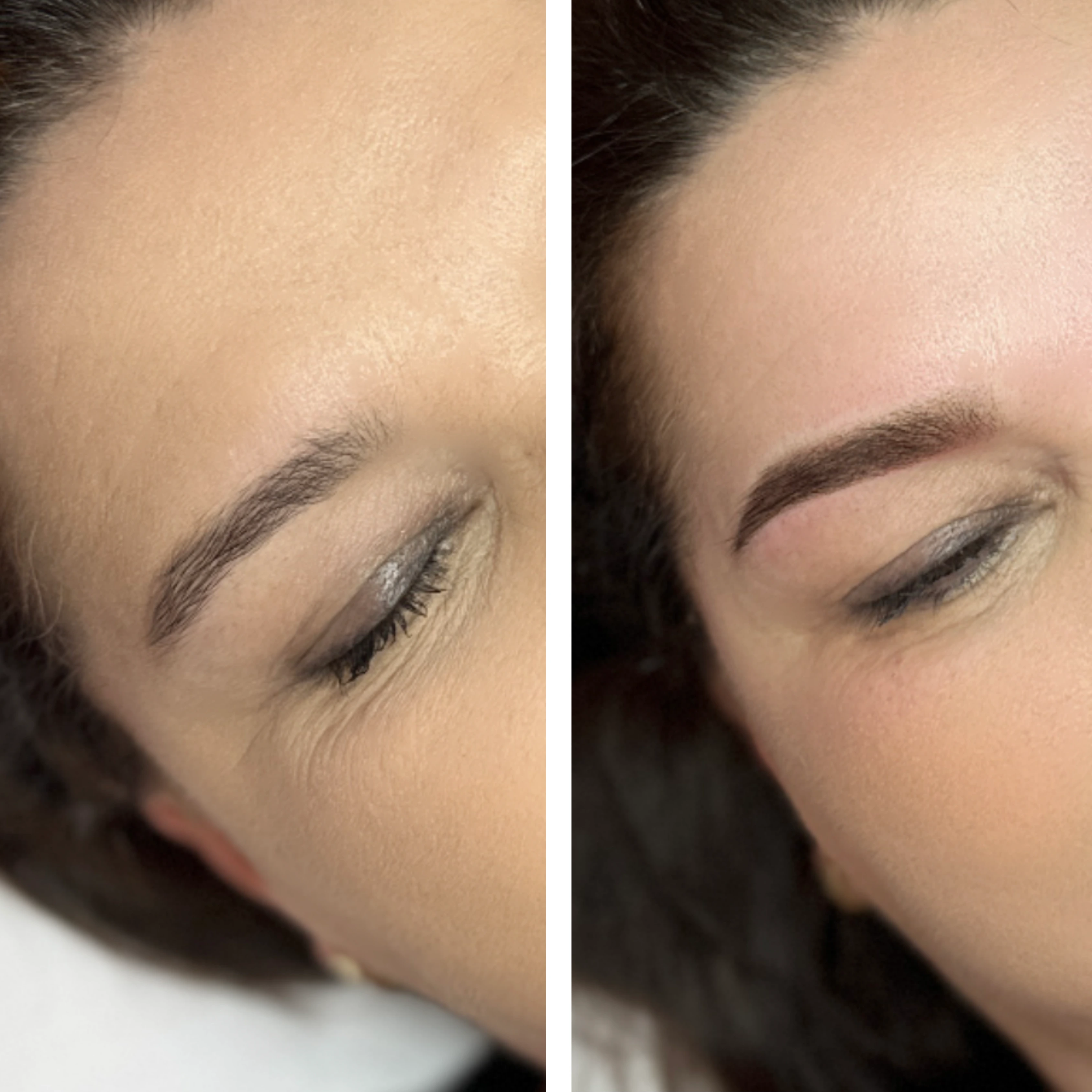 Before-After 5