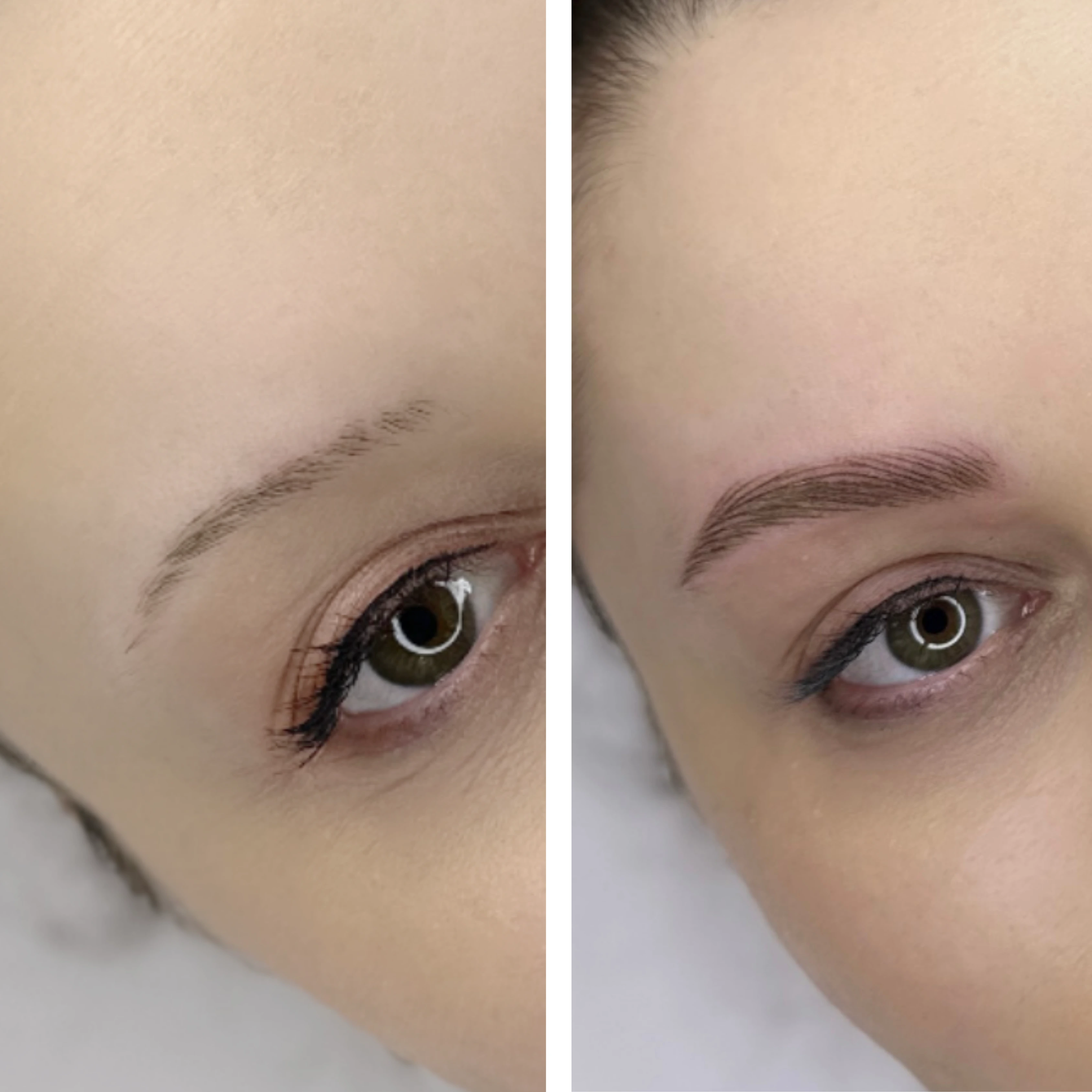 Before-After 6