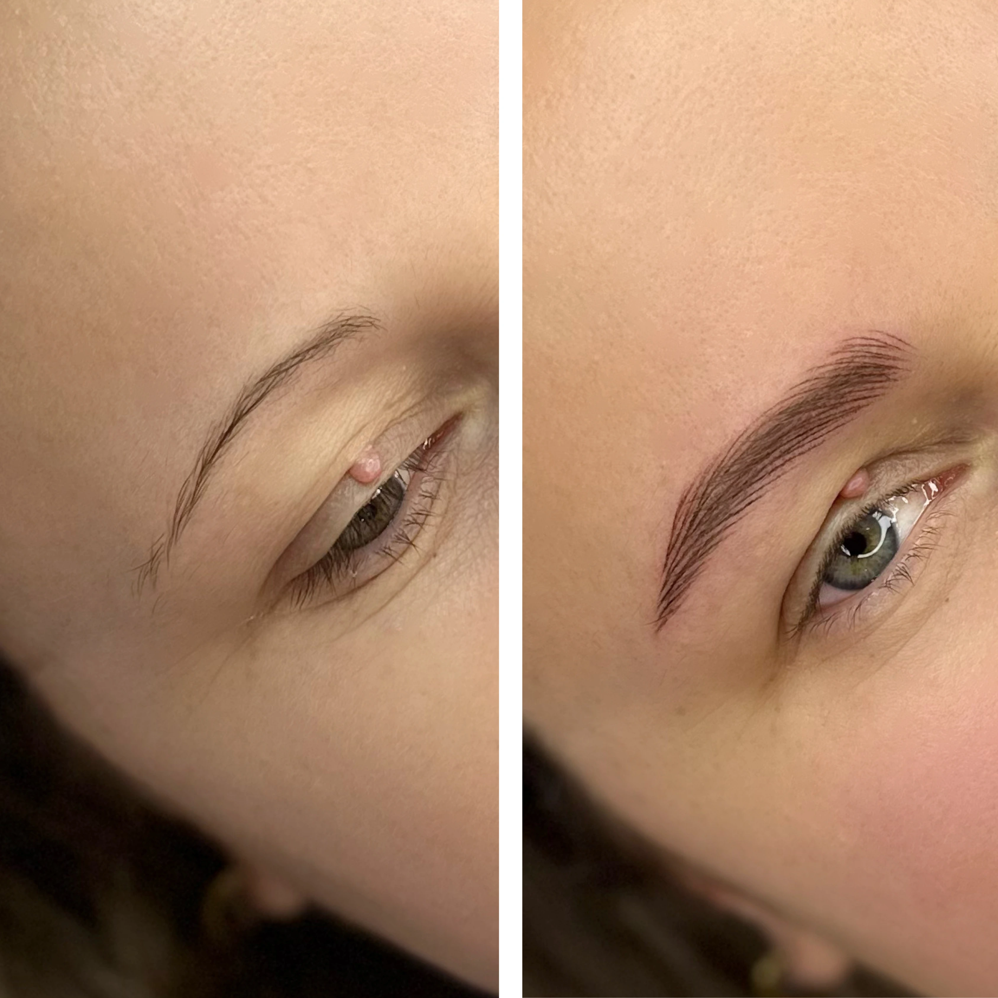 Before-After 7