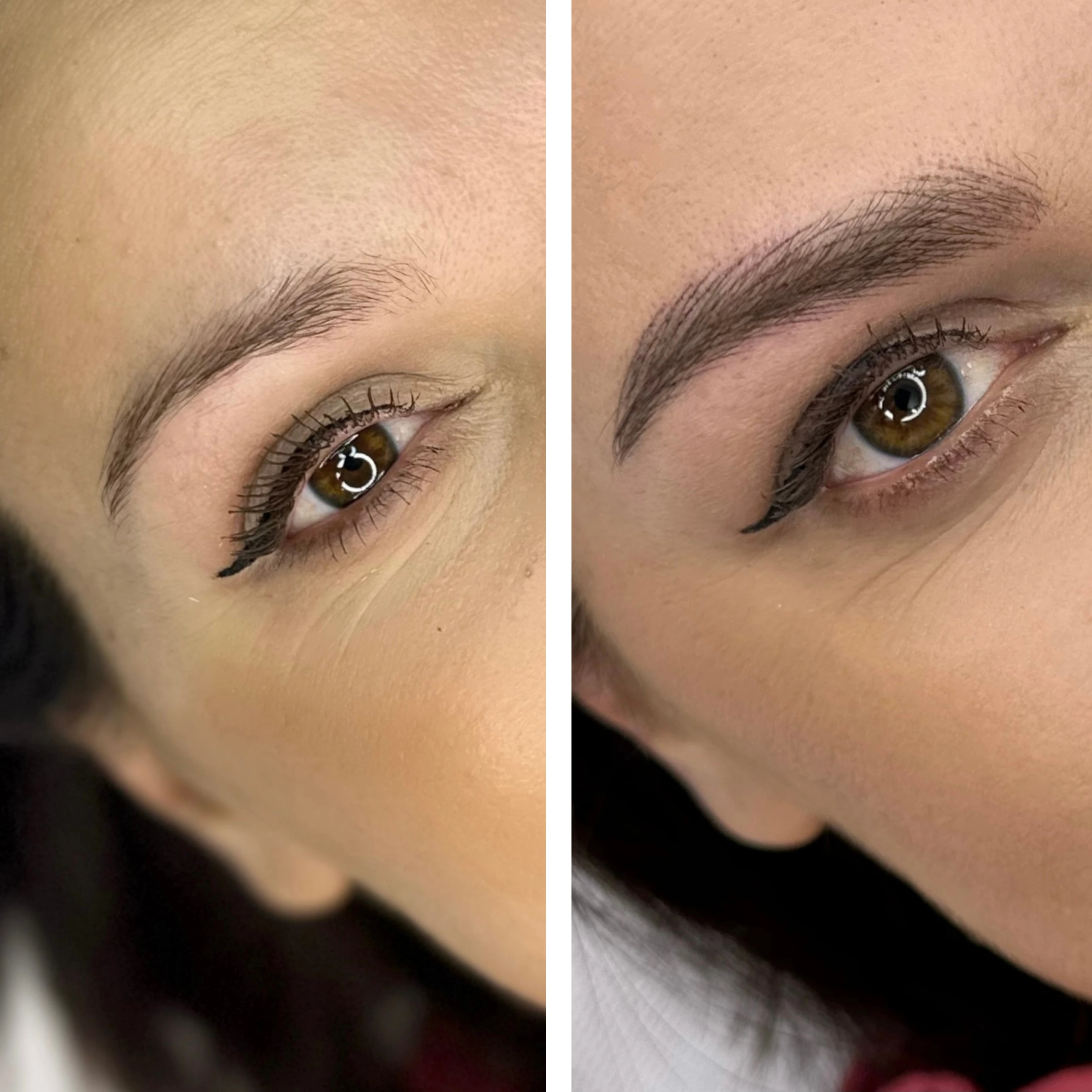 Before-After 1