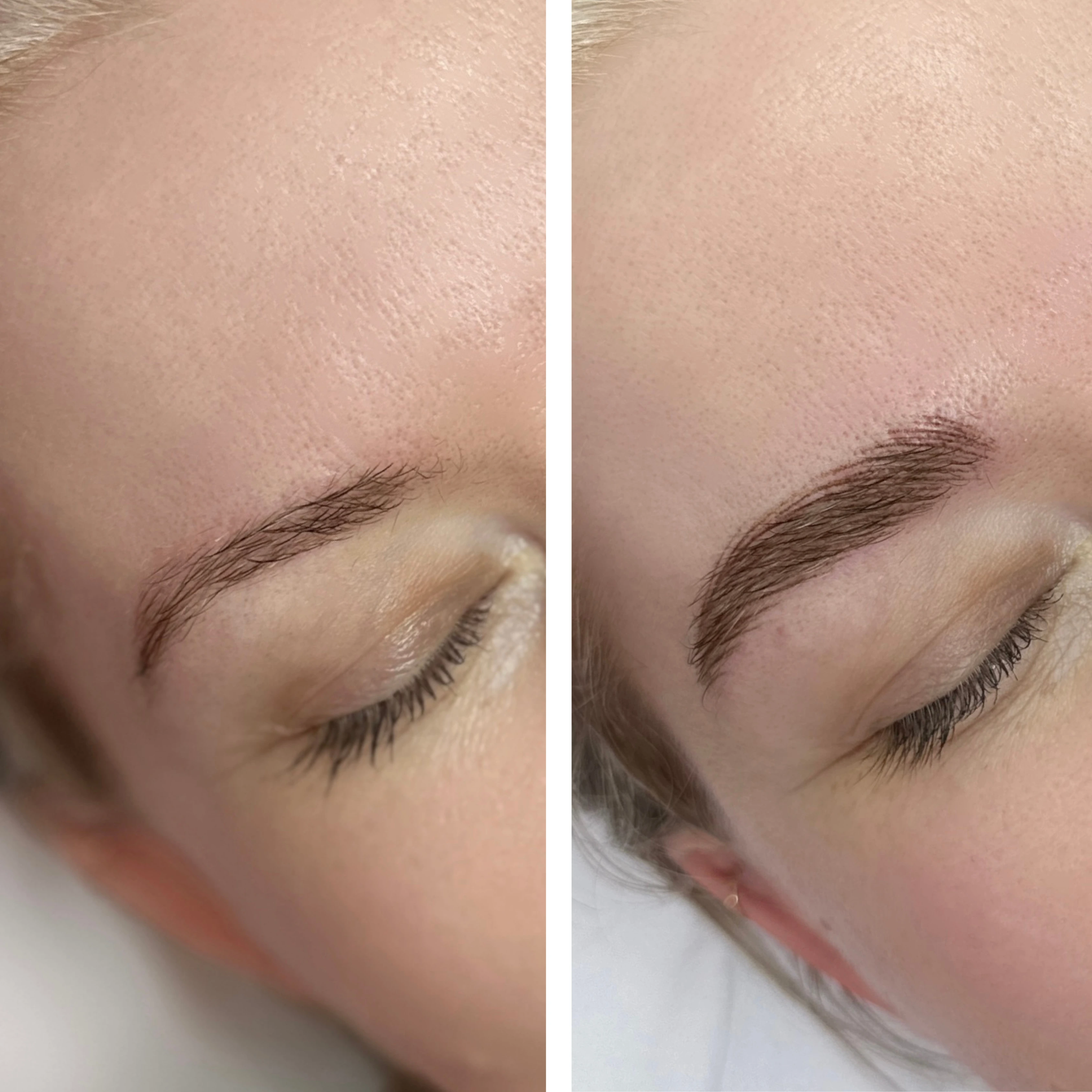 Before-After 2