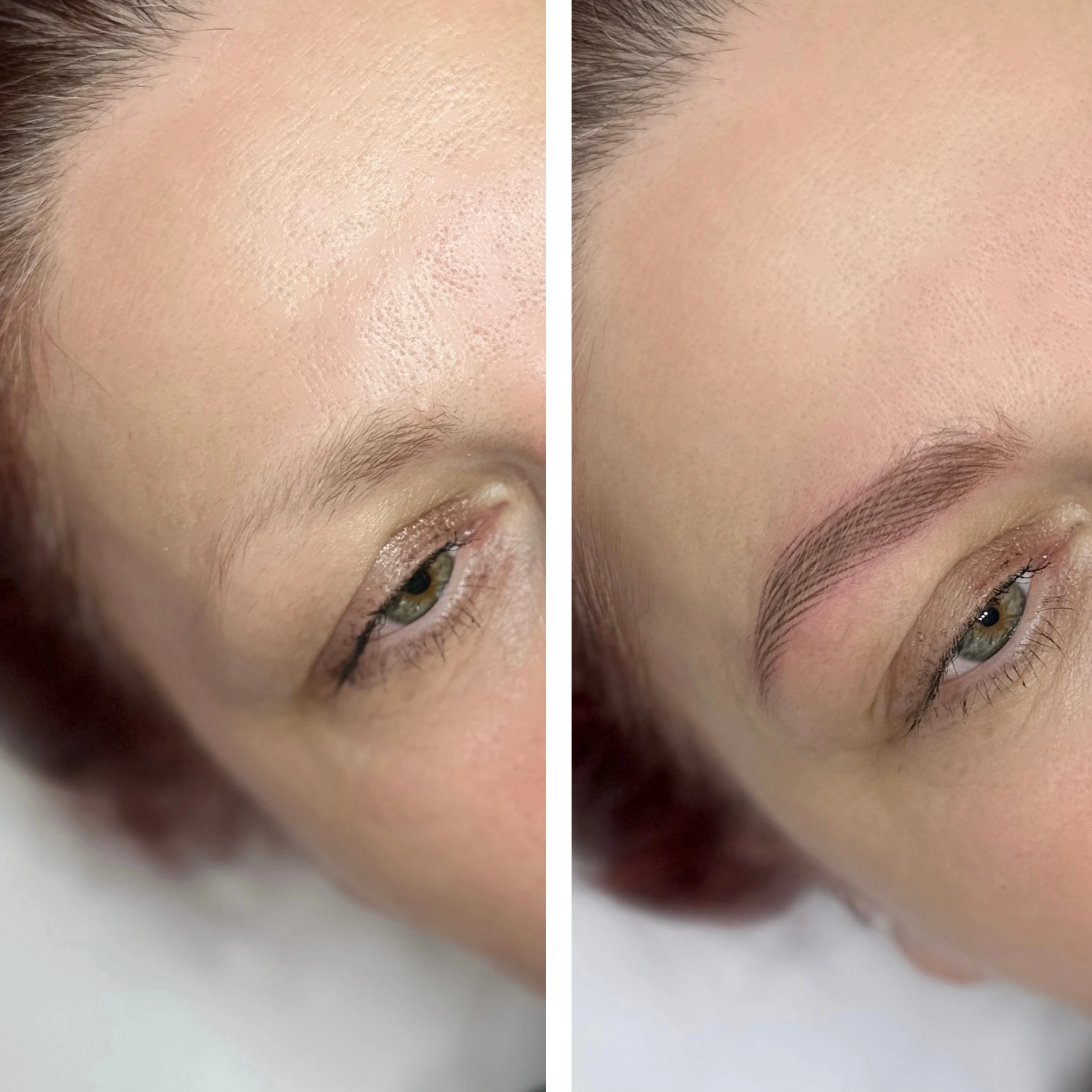 Before-After 3