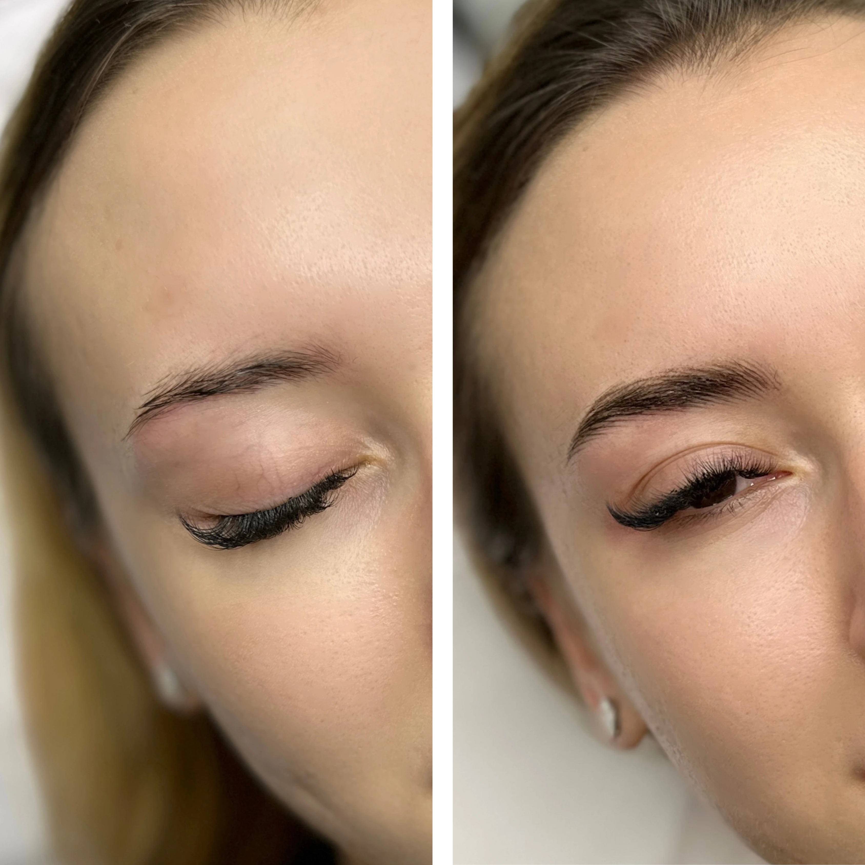 Before-After 4