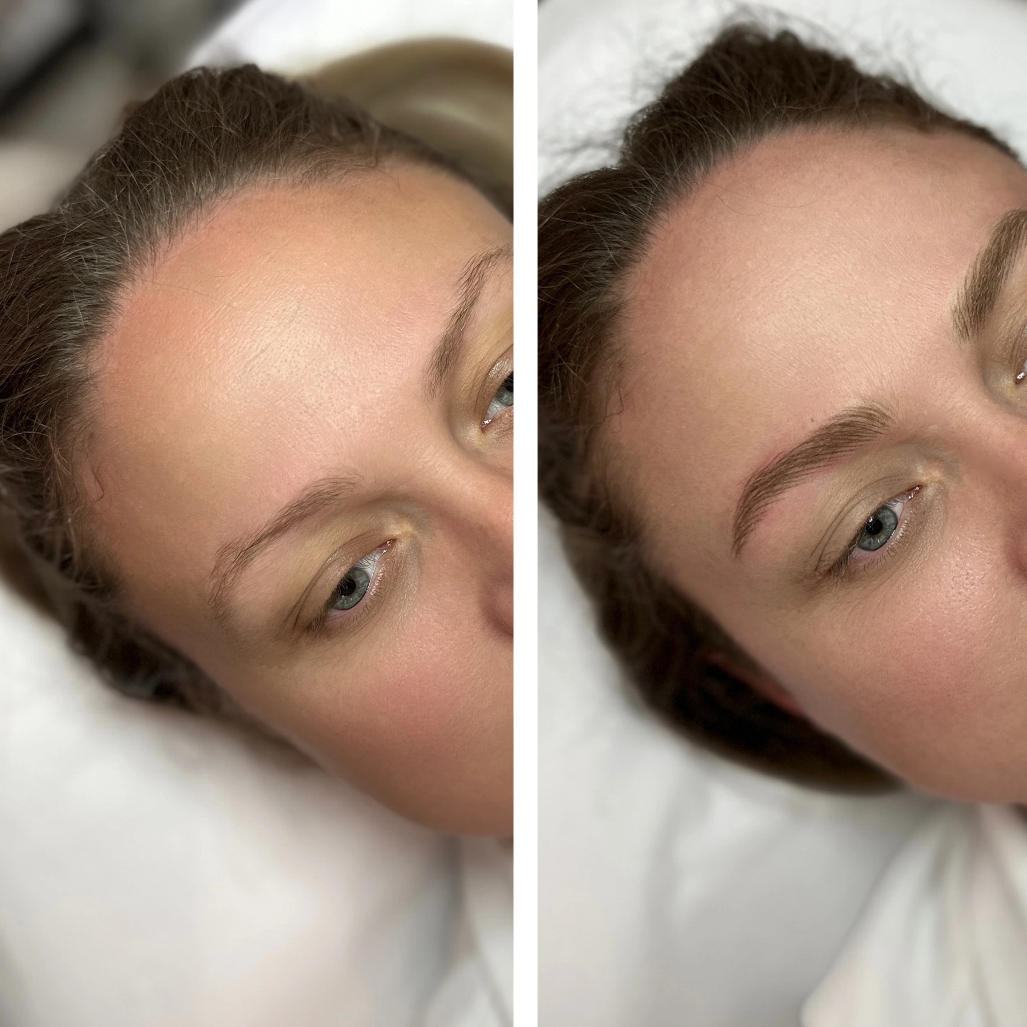 Before-After 5