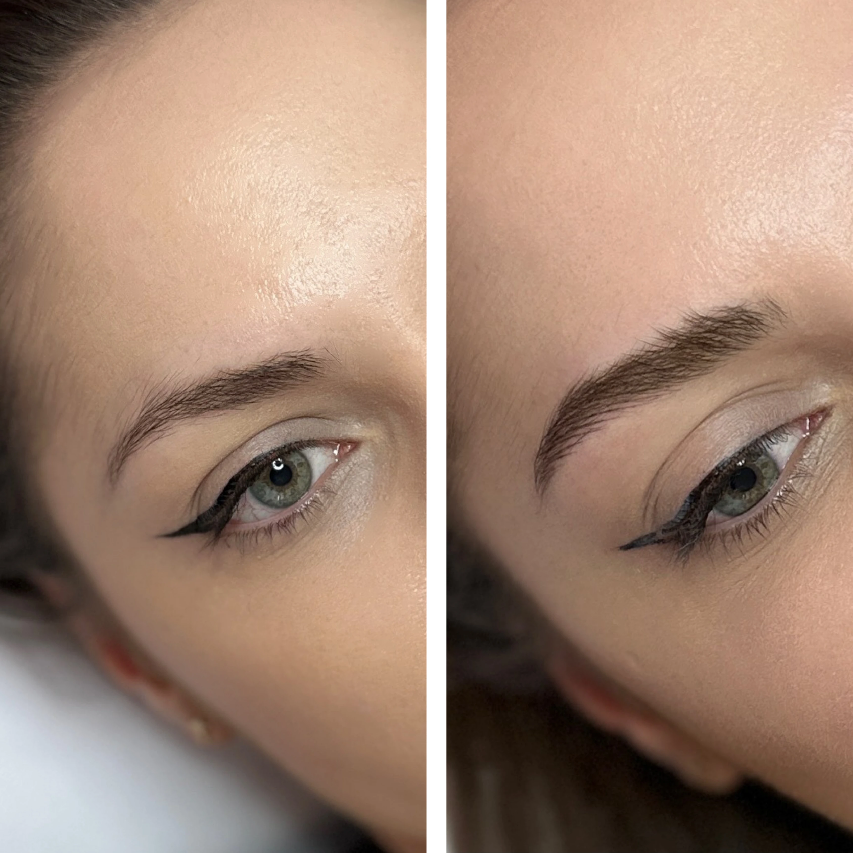 Before-After 6