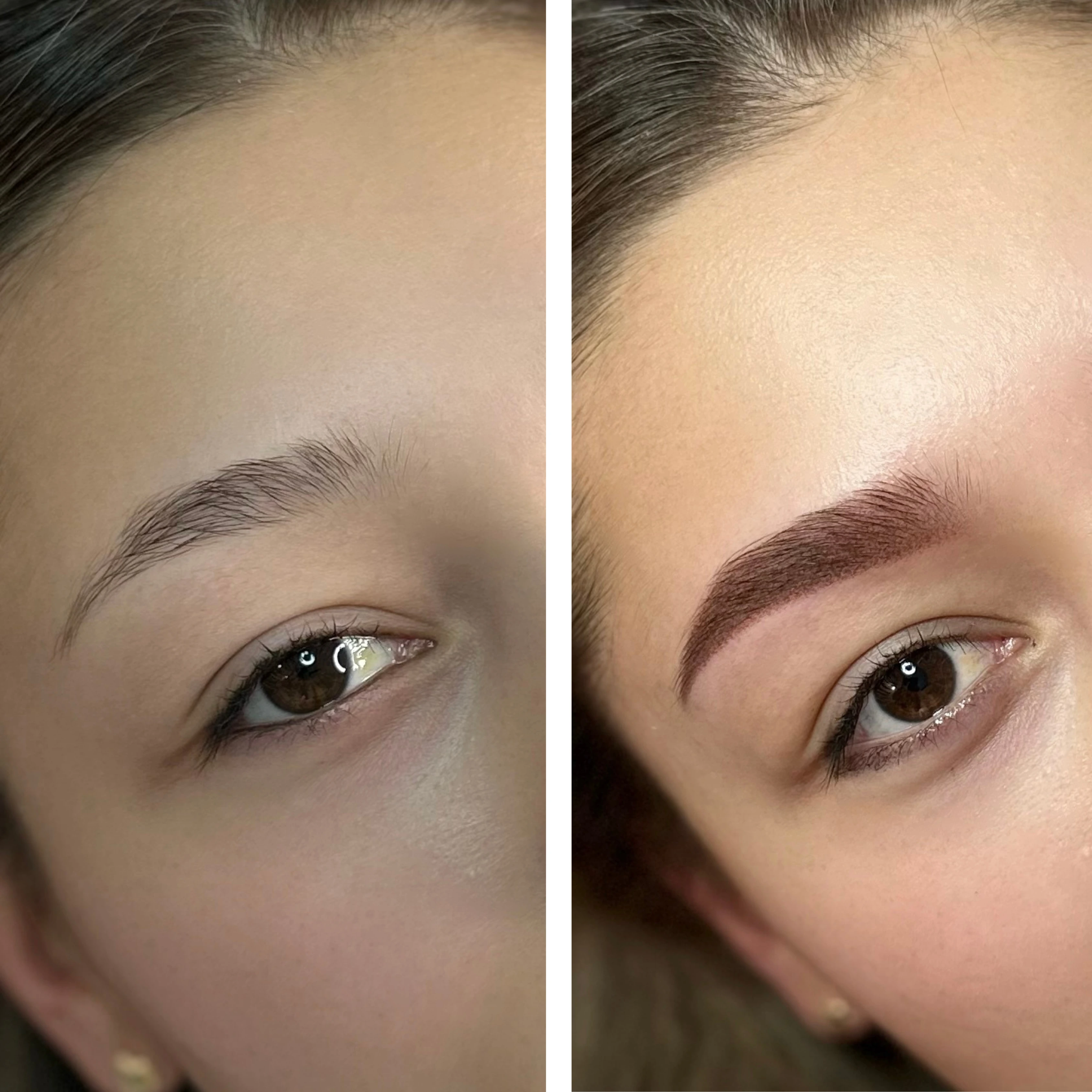 Before-After 7